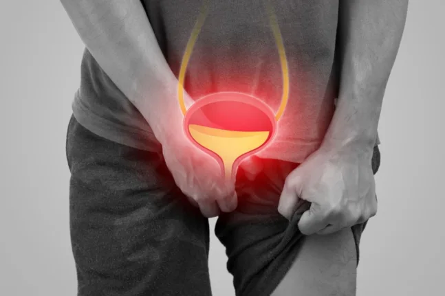 Ιός της παιδικής ηλικίας συνδέεται με καρκίνο της ουροδόχου κύστης δεκαετίες αργότερα