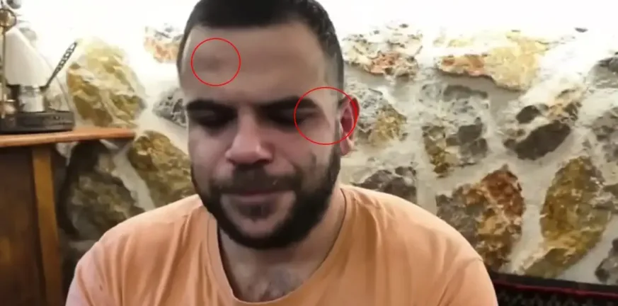 «Θεέ μου, θα πάρουμε την αστυνομία», γνωστός Youtuber έπεσε ξανά θύμα ξυλοδαρμού σε live μετάδοση, ΒΙΝΤΕΟ