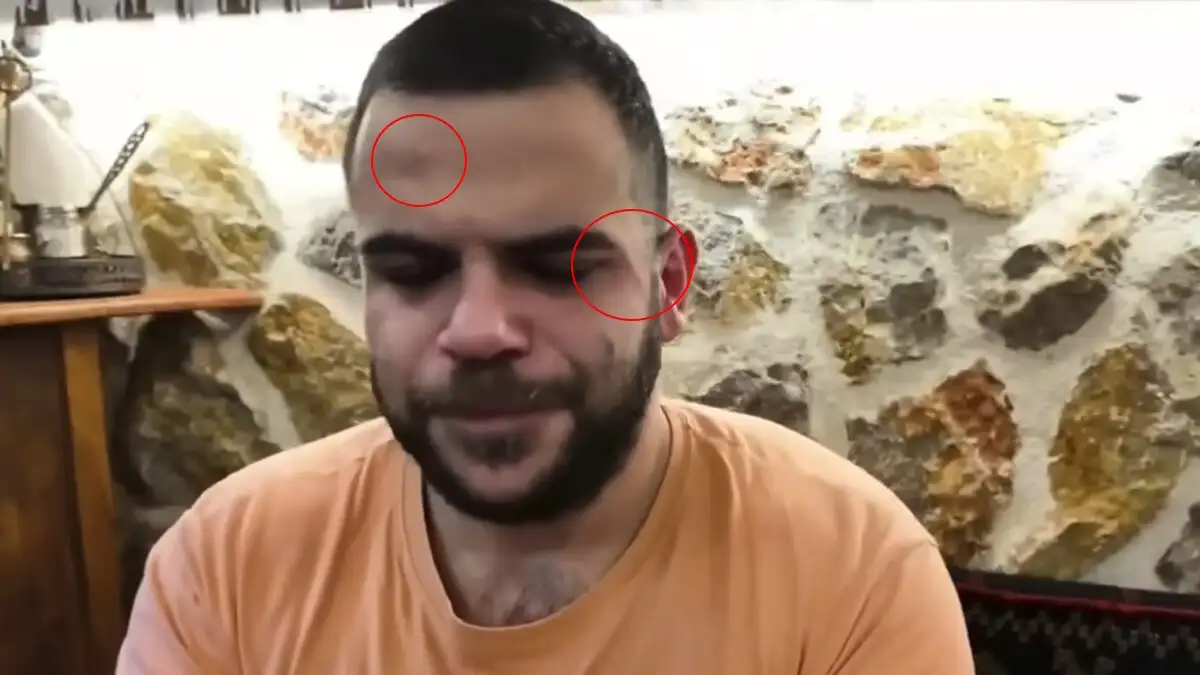 «Θεέ μου, θα πάρουμε την αστυνομία», γνωστός Youtuber έπεσε ξανά θύμα ξυλοδαρμού σε live μετάδοση, ΒΙΝΤΕΟ