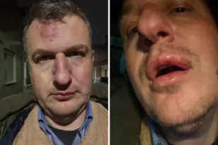 Επίθεση σε εκδότη στον Βόλο: Χτυπήθηκε άγρια έξω από το σπίτι του - Μήνυση κατά αγνώστων