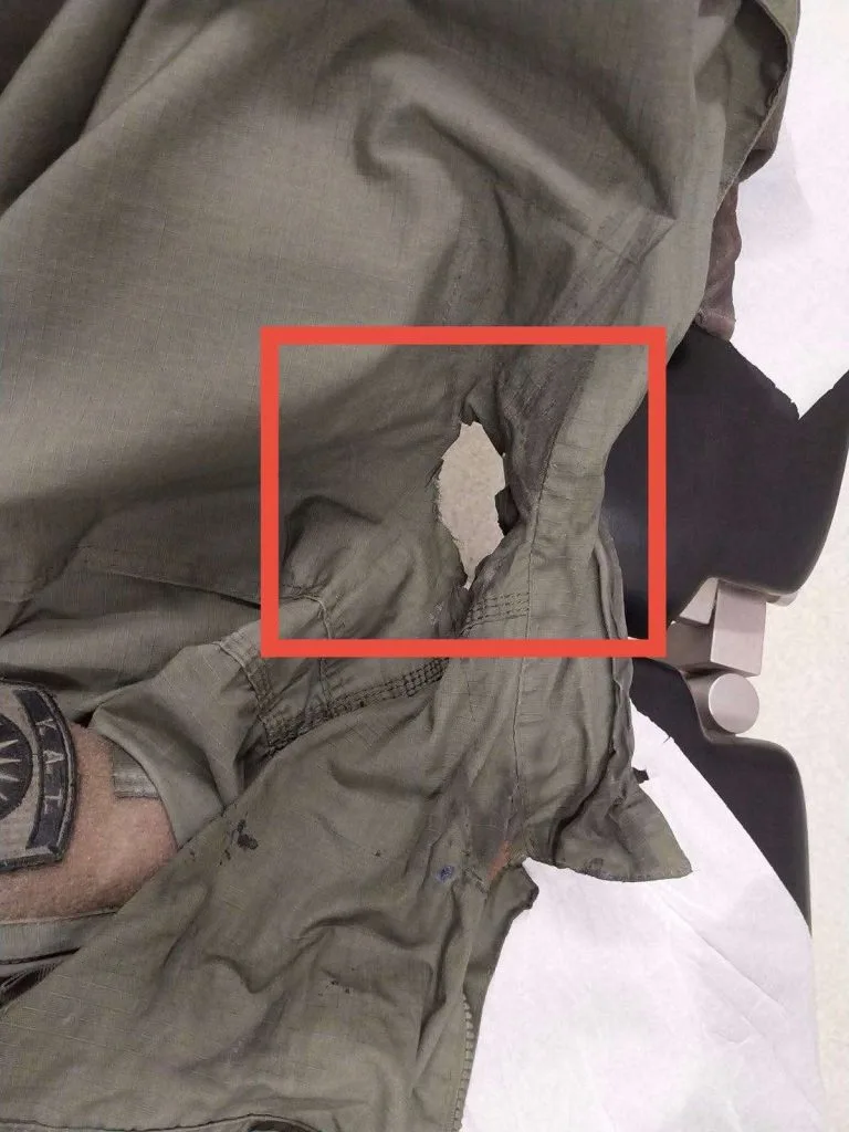 Θεσσαλονίκη: Τρύπα από μολότοφ στη στολή του αστυνομικού ΦΩΤΟ