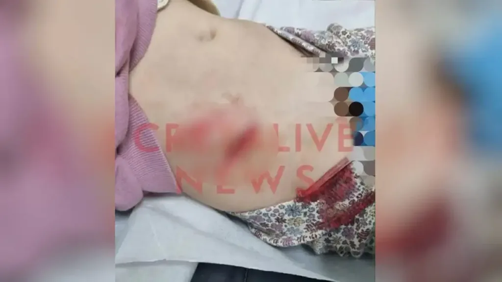 Ηράκλειο: 4χρονη έπεσε σε ανοιχτό φρεάτιο - Από τύχη αποφεύχθηκαν τα χειρότερα ΦΩΤΟ