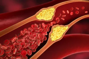 Το «πρωινό» τρόφιμο που μειώνει τη χοληστερίνη