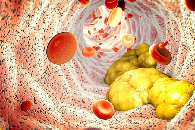 Χοληστερόλη: Με έξυπνη δίαιτα δύο ημερών μπορείτε να τη ρίξετε με «κλειδί» τη βρώμη