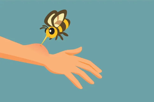Από το πρήξιμο στην αναφυλαξία: τι πρέπει να γνωρίζουμε μετά από τσίμπημα μέλισσας