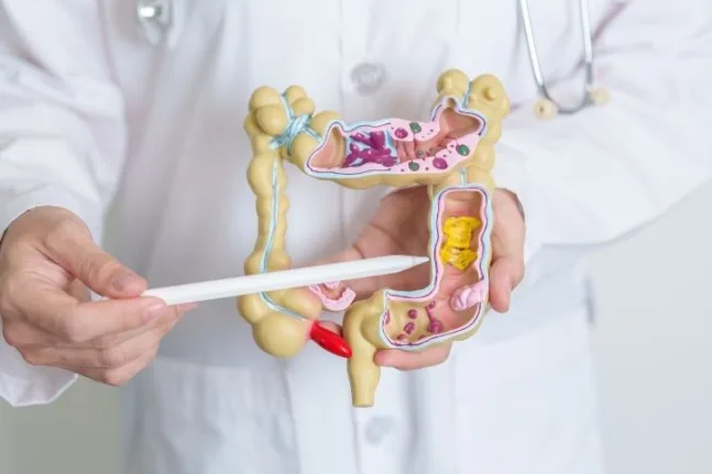 5 τροφές πλούσιες σε φυτικές ίνες που μειώνουν τον κίνδυνο καρκίνου του παχέος εντέρου