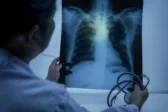 Δυτική Ελλάδα: Σχέδιο δράσης για φυματίωση και λεπτοσπείρωση – Στο μικροσκόπιο οι περιοχές Δ. Αχαΐας, Μανωλάδας και Αμαλιάδας