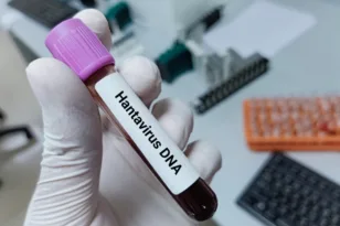 Ισπανία: Συναγερμός, θετικός σε χανταϊό επιβάτης του MV Hondius που βρισκόταν σε καραντίνα