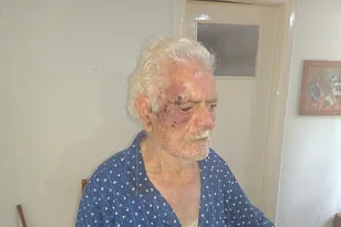 Πάτρα: Σοκ στην πλ. Μπακογιάννη – Αγρια ληστεία με θύματα ηλικιωμένο ζευγάρι μέσα στο σπίτι του