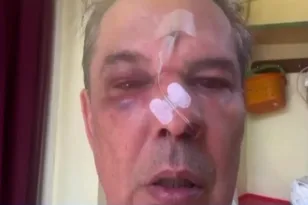 «Μου ‘χει σπάσει το κόκκαλο στη μύτη, στο διάφραγμα, τα μάτια είναι μπλε και τα δύο», άνδρας περιγράφει τον ξυλοδαρμό του σε ιατρείο