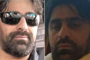 Ομογενής σε κρίσιμη κατάσταση μετά τα εμφυτεύματα στην Τουρκία – Τι λέει η οικογένεια για την αναισθησία