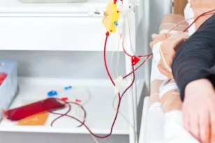 Πλασμαφαίρεση: Τι είναι η ιατρική διαδικασία και σε ποιους ασθενείς εφαρμόζεται